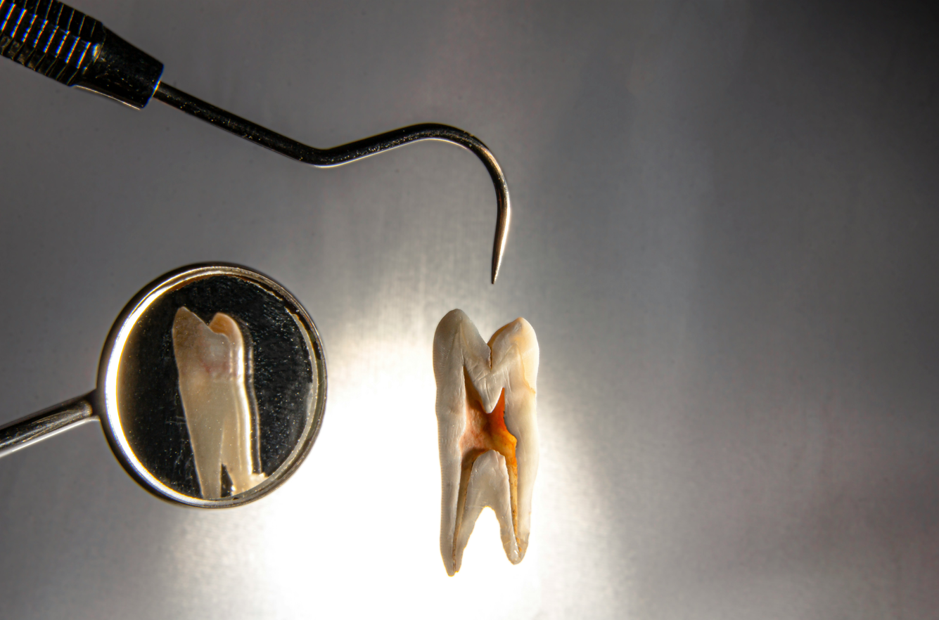 Primary root canal treatment